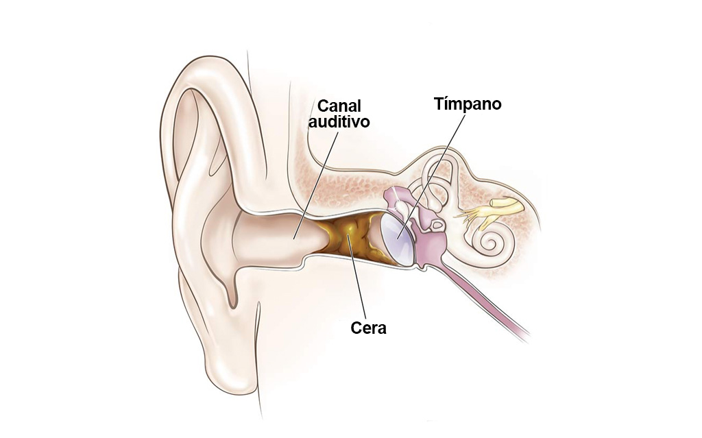 cerumen-y-salud-auditiva